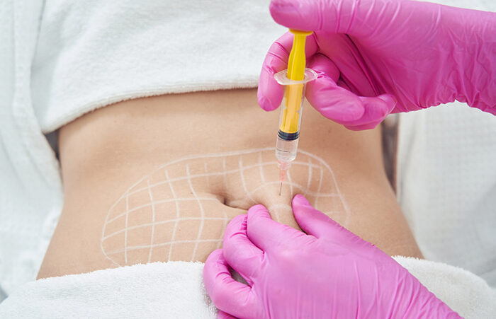 imagem-intradermoterapia imagem-intradermoterapia